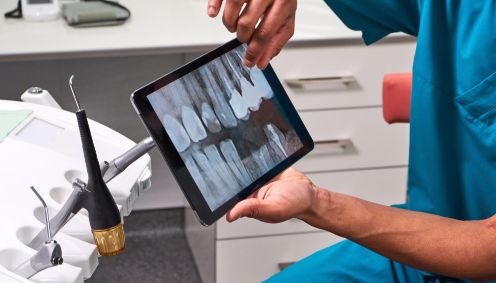 The Rise of Virtual Orthodontic Treatment