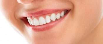 Dental Care Procedures to Improve Your Smile