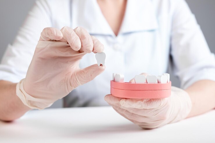 Tooth Replacement Treatments