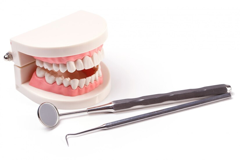 Advantages of Dental Bridges