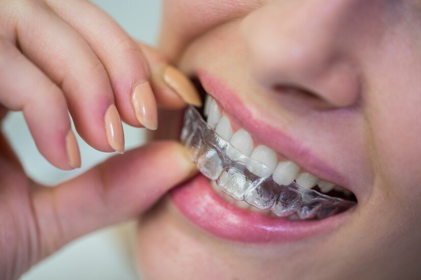 Oral Health Benefits